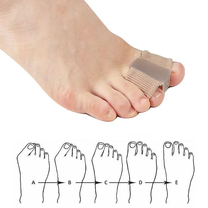 Fiber Toe Separator — product image