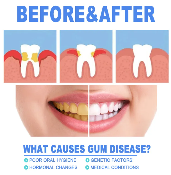 Teeth Repair Gel — product image
