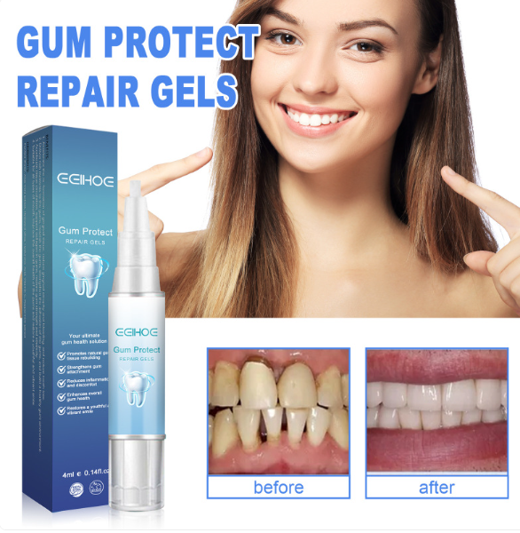 Teeth Repair Gel — product image 3